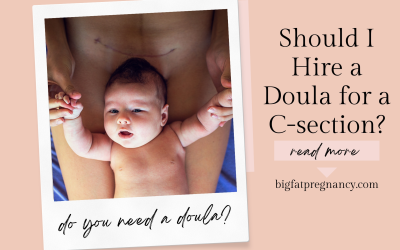 Should I Hire a Doula for a C-section?